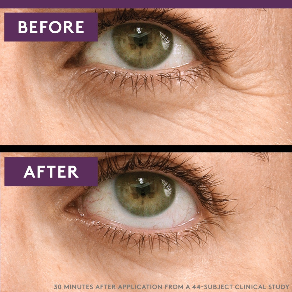 Before and after images showing the effects of Simply Ageless Eye Lift Serum.